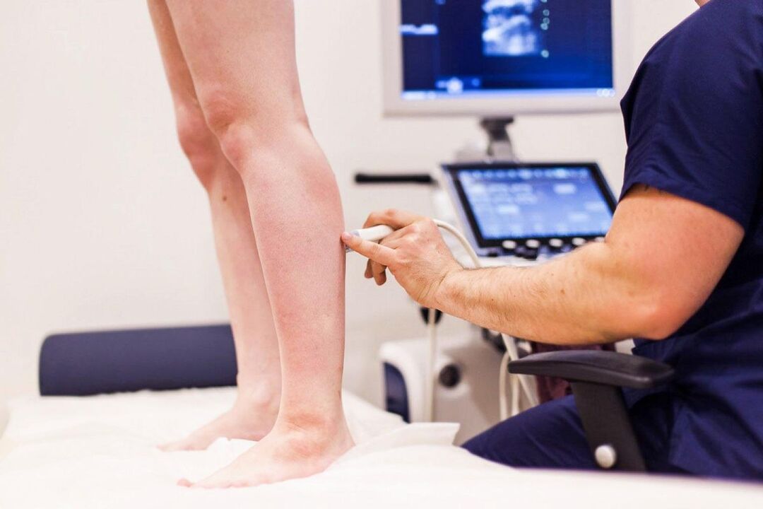 Avant de traiter les varices des jambes, il est nécessaire de poser un diagnostic par échographie. 